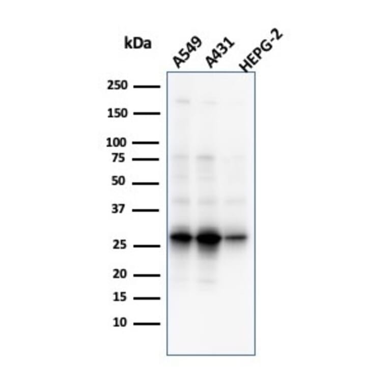 Western Blot - Anti-GCLM Antibody [CPTC-GCLM-1] (A248735) - Antibodies.com