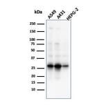 Western Blot - Anti-GCLM Antibody [CPTC-GCLM-1] (A248735) - Antibodies.com