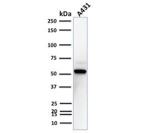 Western Blot - Anti-TOX3 Antibody [TOX3/1123] (A248736) - Antibodies.com