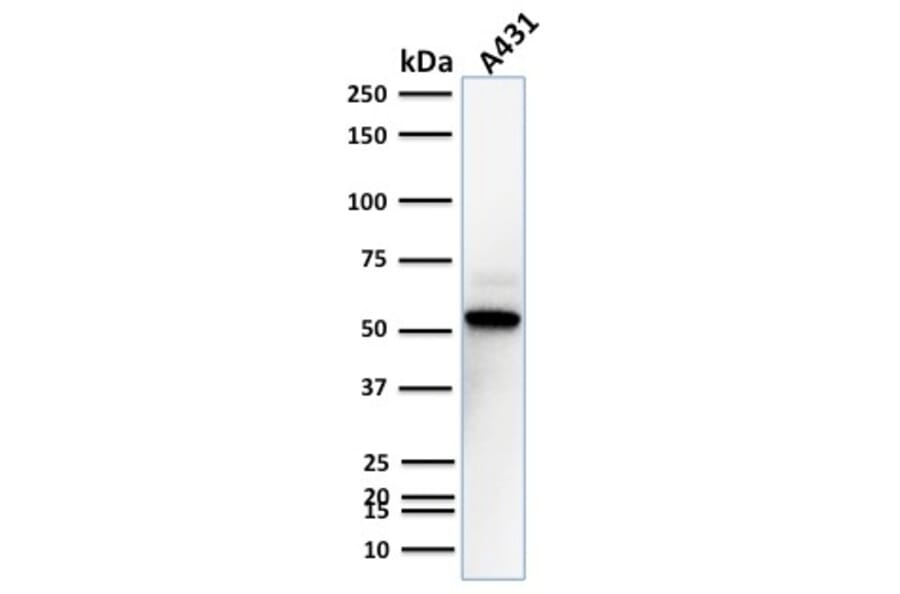Western Blot - Anti-TOX3 Antibody [TOX3/1123] (A248736) - Antibodies.com