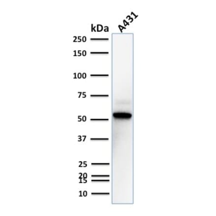 Western Blot - Anti-TOX3 Antibody [TOX3/1123] (A248736) - Antibodies.com