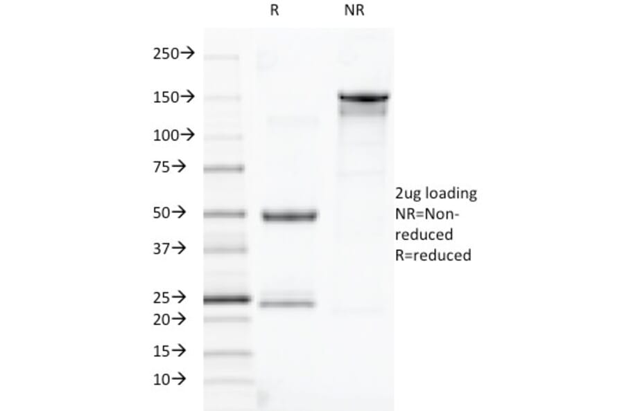 SDS-PAGE - Anti-TOX3 Antibody [TOX3/1123] (A248736) - Antibodies.com
