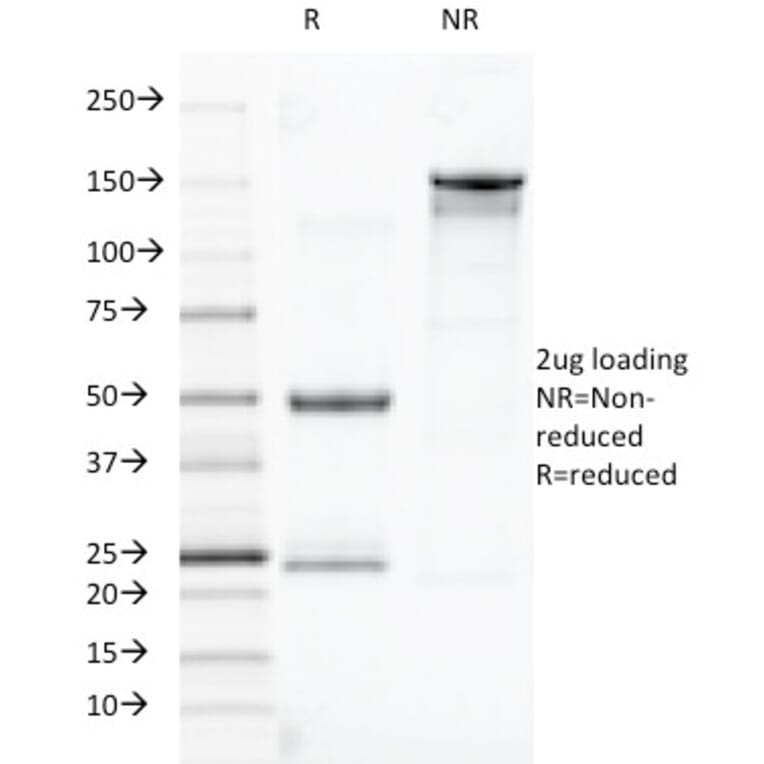 SDS-PAGE - Anti-TOX3 Antibody [TOX3/1123] (A248736) - Antibodies.com