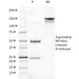 SDS-PAGE - Anti-TOX3 Antibody [TOX3/1123] (A248736) - Antibodies.com