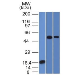 Western Blot - Anti-TOX3 Antibody [TOX3/1124] (A248737) - Antibodies.com
