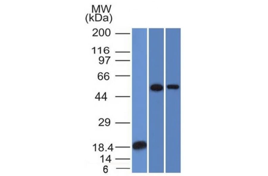 Western Blot - Anti-TOX3 Antibody [TOX3/1124] (A248737) - Antibodies.com