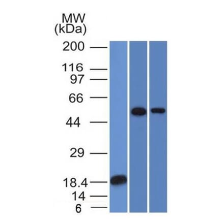 Western Blot - Anti-TOX3 Antibody [TOX3/1124] (A248737) - Antibodies.com