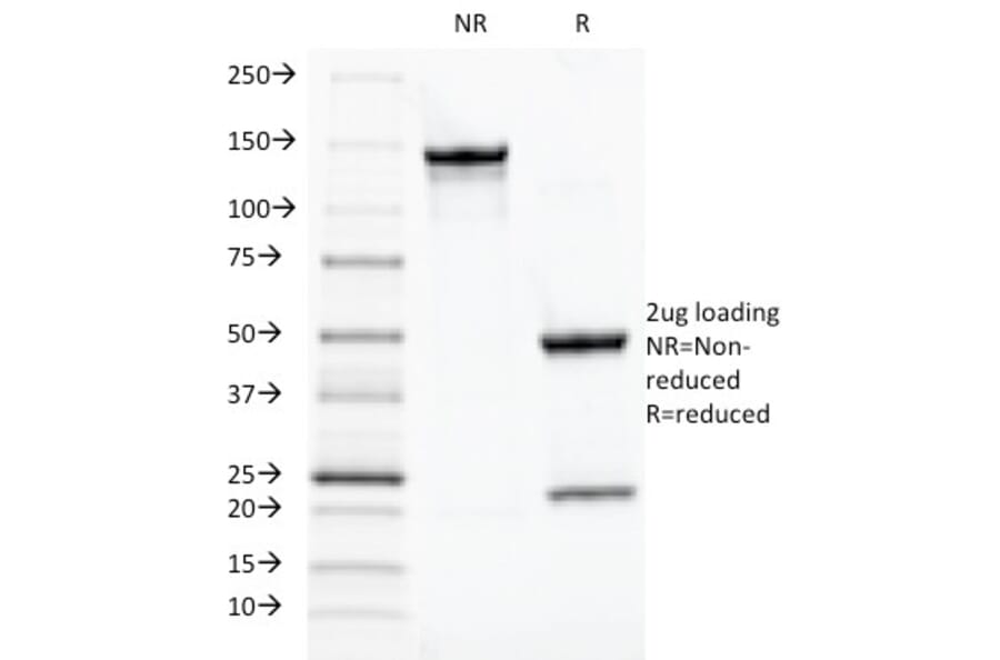 SDS-PAGE - Anti-TOX3 Antibody [TOX3/1124] (A248736) - Antibodies.com