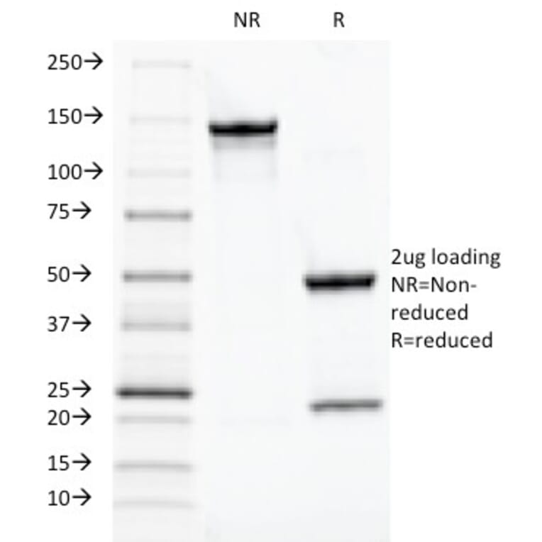 SDS-PAGE - Anti-TOX3 Antibody [TOX3/1124] (A248736) - Antibodies.com