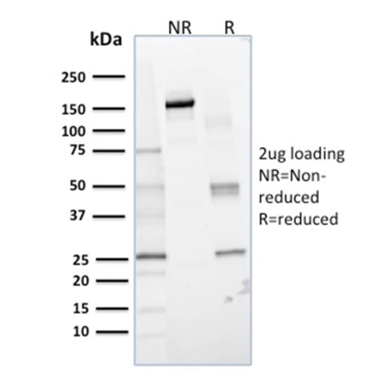 SDS-PAGE - Anti-Glyoxalase 1 Antibody [CPTC-GLO1-1] (A254318) - Antibodies.com