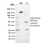 SDS-PAGE - Anti-Glyoxalase 1 Antibody [CPTC-GLO1-1] (A254318) - Antibodies.com