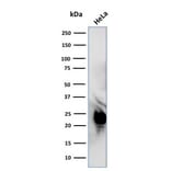 Western Blot - Anti-Glyoxalase 1 Antibody [CPTC-GLO1-1] (A251957) - Antibodies.com