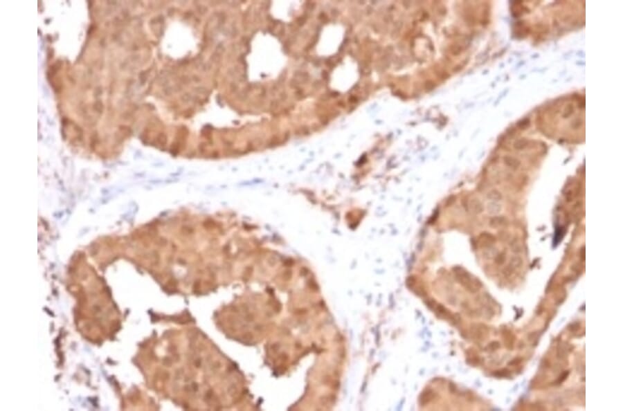 Immunohistochemistry - Anti-Glyoxalase 1 Antibody [CPTC-GLO1-1] (A252279) - Antibodies.com