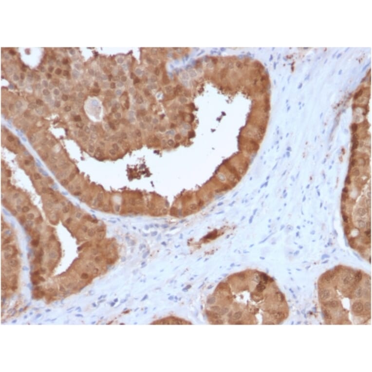 Immunohistochemistry - Anti-Glyoxalase 1 Antibody [CPTC-GLO1-3] (A248739) - Antibodies.com