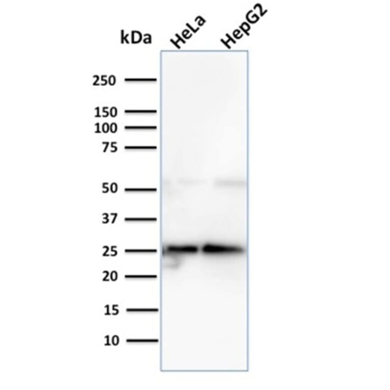 Western Blot - Anti-Glyoxalase 1 Antibody [CPTC-GLO1-3] (A248740) - Antibodies.com