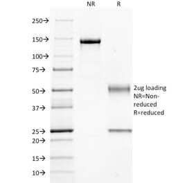 SDS-PAGE - Anti-GNAQ Antibody [GNAQ/2434] (A248740) - Antibodies.com