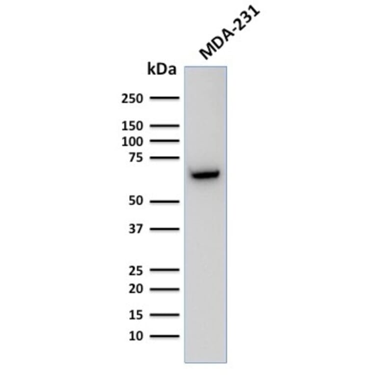 Western Blot - Anti-GnRHR Antibody [F1G4] (A248742) - Antibodies.com