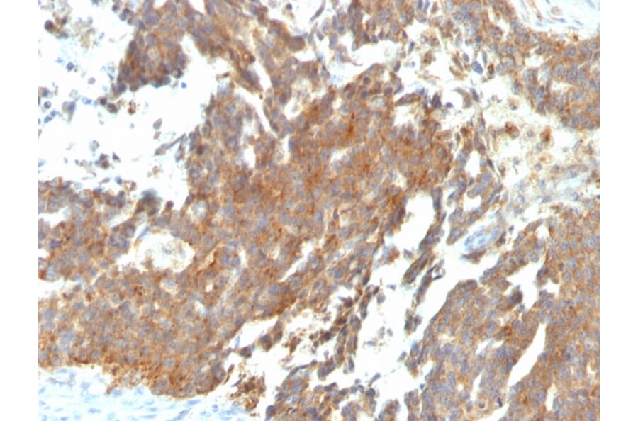 Immunohistochemistry - Anti-GnRHR Antibody [GNRHR/768] (A248744) - Antibodies.com