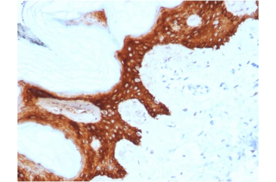 Immunohistochemistry - Anti-14-3-3 Sigma Antibody [CPTC-SFN-2] (A248746) - Antibodies.com