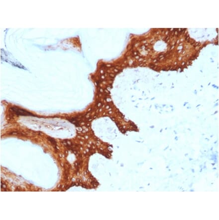 Immunohistochemistry - Anti-14-3-3 Sigma Antibody [CPTC-SFN-2] (A248746) - Antibodies.com