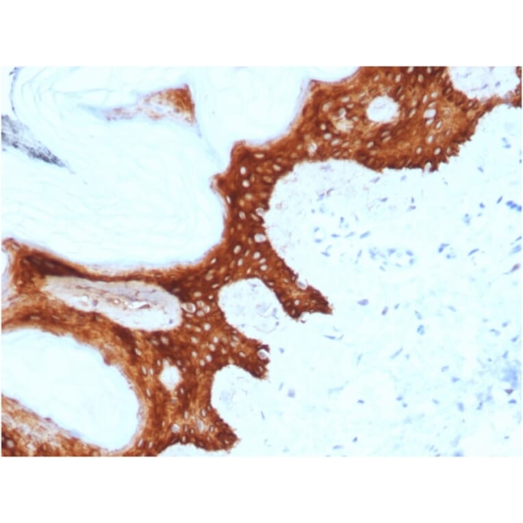 Immunohistochemistry - Anti-14-3-3 Sigma Antibody [CPTC-SFN-2] (A248746) - Antibodies.com