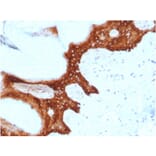Immunohistochemistry - Anti-14-3-3 Sigma Antibody [CPTC-SFN-2] (A248746) - Antibodies.com