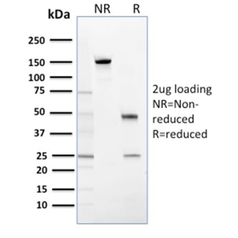 SDS-PAGE - Anti-14-3-3 Sigma Antibody [CPTC-SFN-2] (A248746) - Antibodies.com