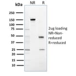 SDS-PAGE - Anti-14-3-3 Sigma Antibody [CPTC-SFN-2] (A248746) - Antibodies.com