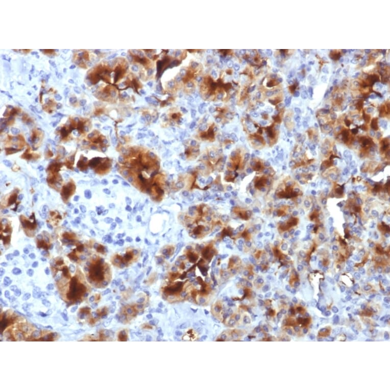 Immunohistochemistry - Anti-Glycoprotein 2 Antibody [GP2/1712] (A248747) - Antibodies.com