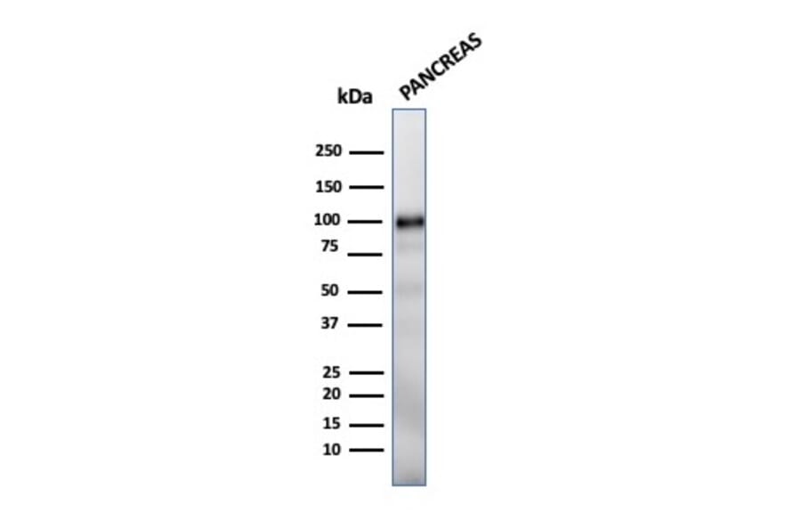 Western Blot - Anti-Glycoprotein 2 Antibody [GP2/1712] (A248747) - Antibodies.com