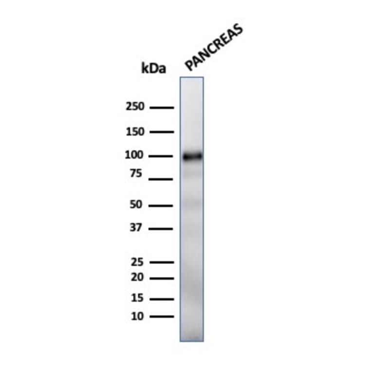 Western Blot - Anti-Glycoprotein 2 Antibody [GP2/1712] (A248747) - Antibodies.com