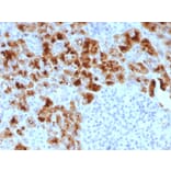Immunohistochemistry - Anti-Glycoprotein 2 Antibody [GP2/1803] (A248748) - Antibodies.com