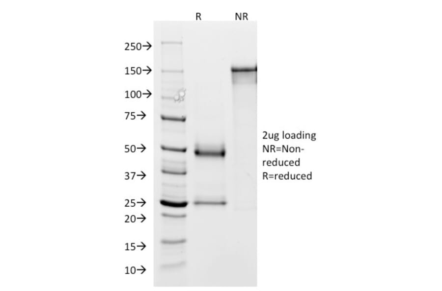 SDS-PAGE - Anti-Glycoprotein 2 Antibody [GP2/1803] (A248748) - Antibodies.com