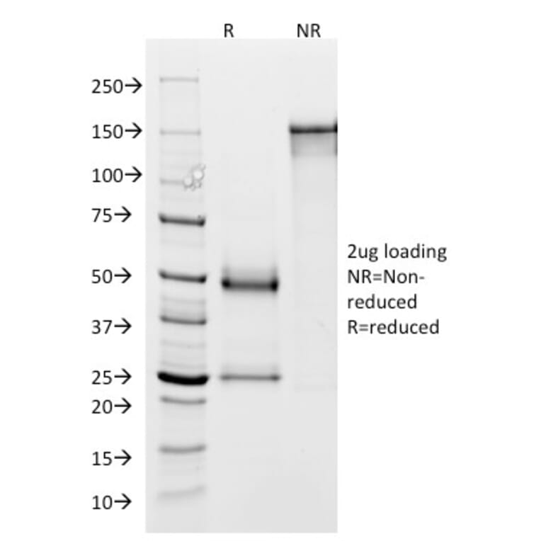 SDS-PAGE - Anti-Glycoprotein 2 Antibody [GP2/1803] (A248748) - Antibodies.com