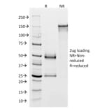 SDS-PAGE - Anti-Glycoprotein 2 Antibody [GP2/1803] (A248748) - Antibodies.com
