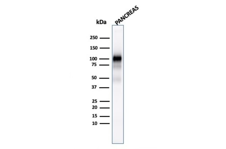 Western Blot - Anti-Glycoprotein 2 Antibody [GP2/1803] (A248748) - Antibodies.com