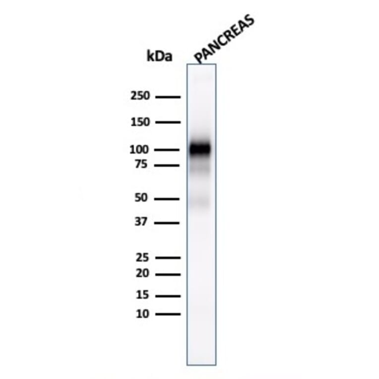 Western Blot - Anti-Glycoprotein 2 Antibody [GP2/1803] (A248748) - Antibodies.com