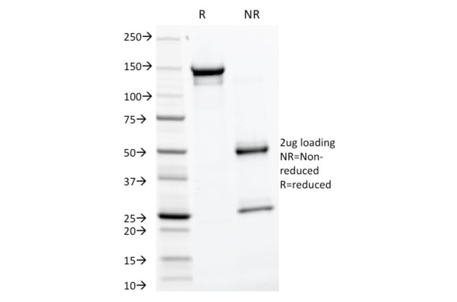 SDS-PAGE - Anti-Glycoprotein 2 Antibody [GP2/1805] (A248749) - Antibodies.com