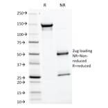 SDS-PAGE - Anti-Glycoprotein 2 Antibody [GP2/1805] (A248749) - Antibodies.com