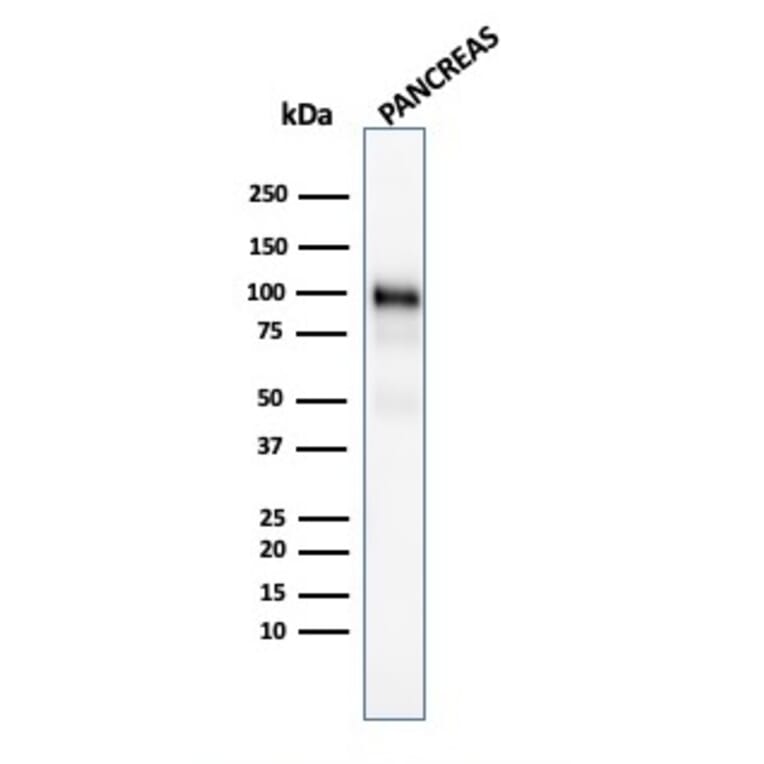 Western Blot - Anti-Glycoprotein 2 Antibody [GP2/1805] (A248749) - Antibodies.com