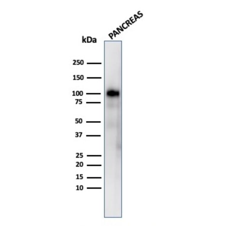 Western Blot - Anti-Glycoprotein 2 Antibody [GP2/3416] (A248750) - Antibodies.com