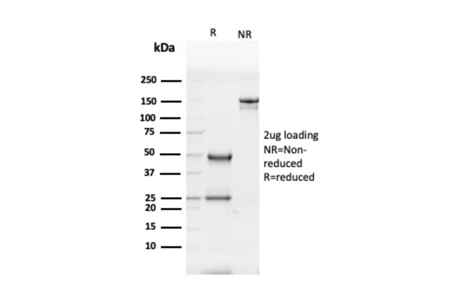 SDS-PAGE - Anti-Glycoprotein 2 Antibody [GP2/3416] (A248750) - Antibodies.com