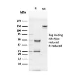 SDS-PAGE - Anti-Glycoprotein 2 Antibody [GP2/3416] (A248750) - Antibodies.com