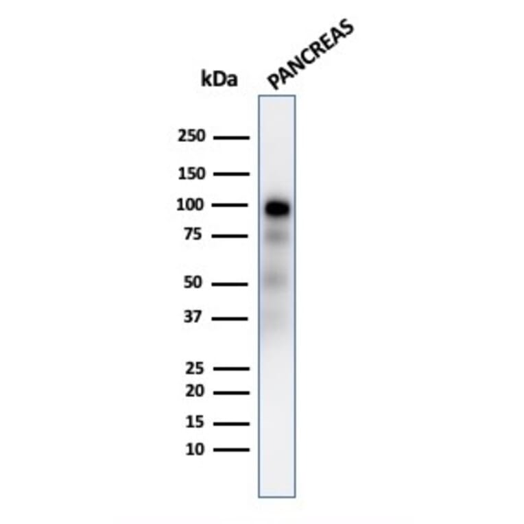 Western Blot - Anti-Glycoprotein 2 Antibody [GP2/2569R] (A248751) - Antibodies.com
