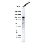 Western Blot - Anti-Glycoprotein 2 Antibody [GP2/2569R] (A248751) - Antibodies.com