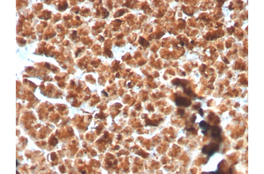 Immunohistochemistry - Anti-Glycoprotein 2 Antibody [GP2/3134R] (A248751) - Antibodies.com