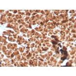Immunohistochemistry - Anti-Glycoprotein 2 Antibody [GP2/3134R] (A248751) - Antibodies.com