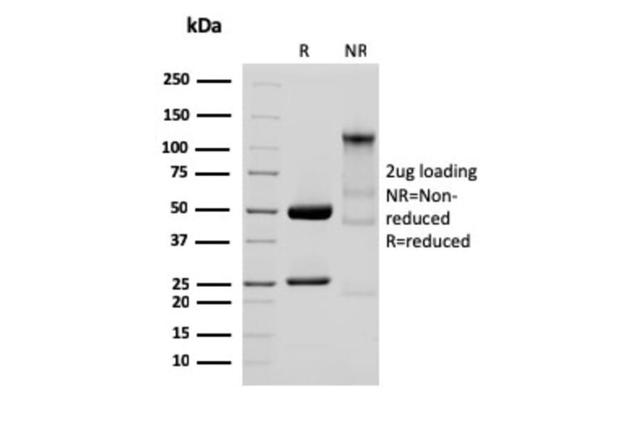 SDS-PAGE - Anti-Glycoprotein 2 Antibody [GP2/3134R] (A248752) - Antibodies.com