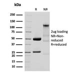 SDS-PAGE - Anti-Glycoprotein 2 Antibody [GP2/3134R] (A248752) - Antibodies.com
