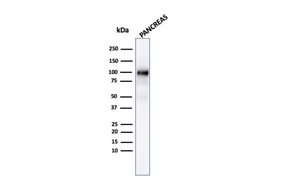 Western Blot - Anti-Glycoprotein 2 Antibody [GP2/3134R] (A248752) - Antibodies.com